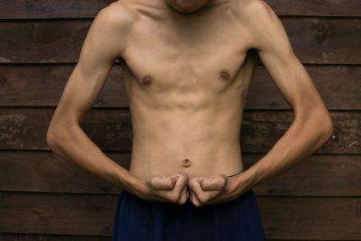 emaciated man flexing