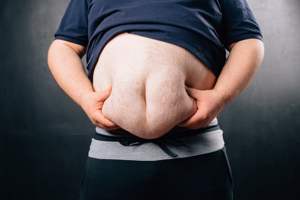 6 Factors That Contribute to Obesity and Why You Should Avoid Becoming Obese