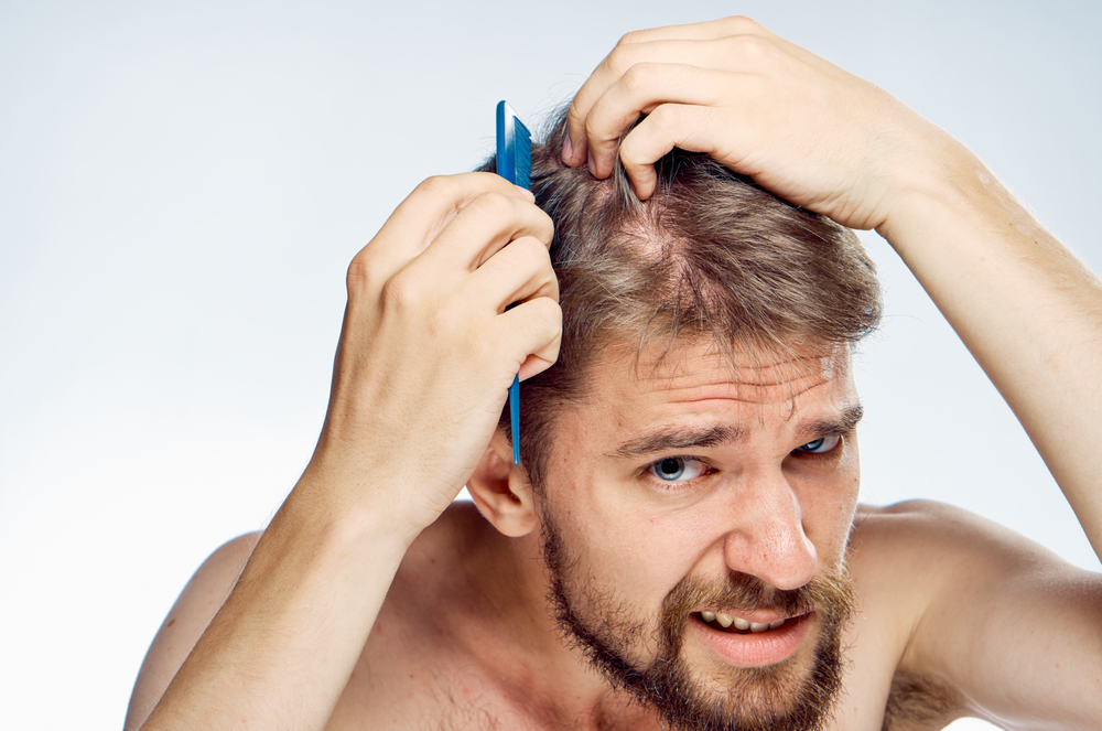 Can Low Testosterone Cause Hair Loss?