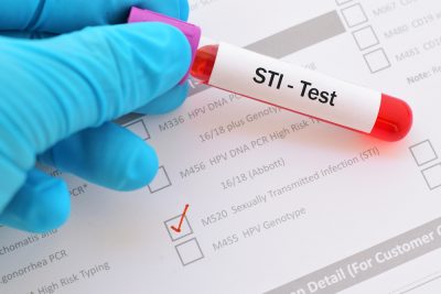 STI test