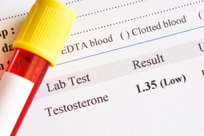 low testosterone level test