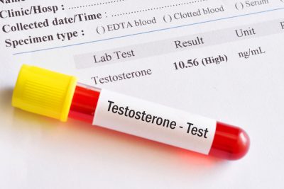 high testosterone level test
