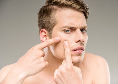 man with pimple