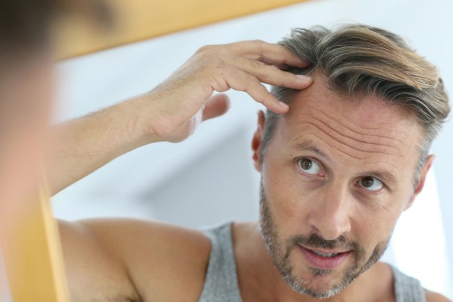 thinning hair