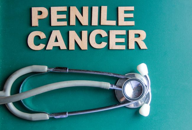 penile cancer